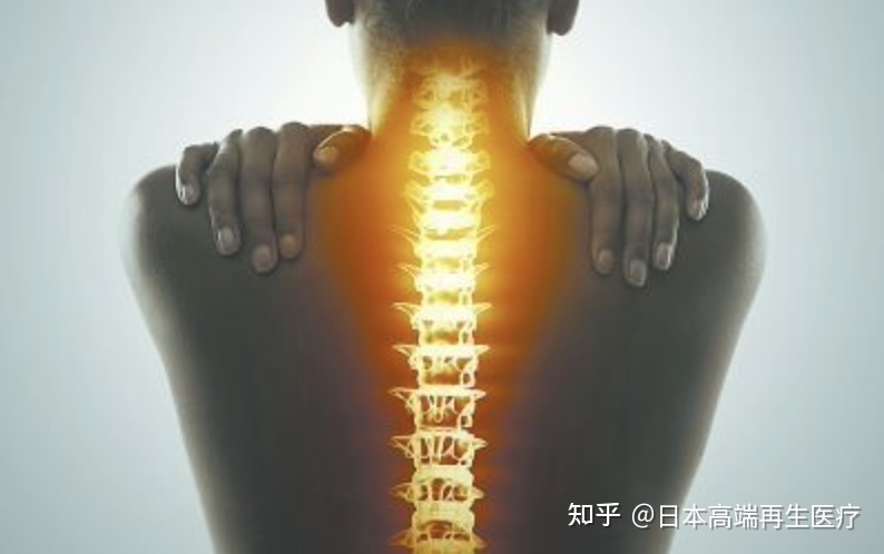 令周杰倫、張嘉譯備受折磨的《癌亡靈》--強直性脊柱炎,干細胞幫您攻克!